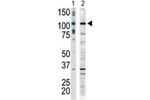 Western Blotting (WB) image for anti-Mitogen-Activated Protein Kinase Kinase Kinase 9 (MAP3K9) antibody (ABIN3003574) (MAP3K9 Antikörper)