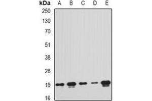 Western blot analysis of PTRH2 expression in MCF7 (A), A549 (B), mouse liver (C), mouse spleen (D), rat brain (E) whole cell lysates. (PTRH2 Antikörper)