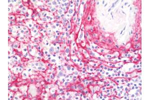 Immunohistochemistry (IHC) image for anti-Collagen, Type VI, alpha 2 (COL6A2) (AA 1-425) antibody (ABIN2595893)