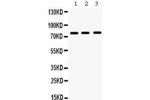 Western Blotting (WB) image for anti-Matrix Metallopeptidase 9 (Gelatinase B, 92kDa Gelatinase, 92kDa Type IV Collagenase) (MMP9) (AA 641-672), (C-Term) antibody (ABIN3043884)