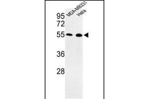 Western blot analysis of EGLN2 Antibody (Center) (ABIN652648 and ABIN2842435) in MDA-M, Hela cell line lysates (35 μg/lane). (PHD1 Antikörper  (AA 194-221))