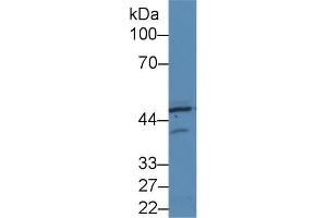 Western blot analysis of Human HeLa cell lysate, using Rat PKR Antibody (2 µg/ml) and HRP-conjugated Goat Anti-Rabbit antibody ( (EIF2AK2 Antikörper  (AA 279-506))
