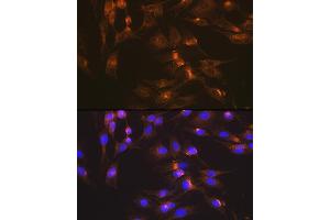 Immunofluorescence analysis of C6 cells using GLUT2/SLC2 Rabbit mAb (ABIN7270414) at dilution of 1:100 (40x lens). (SLC2A2 Antikörper)