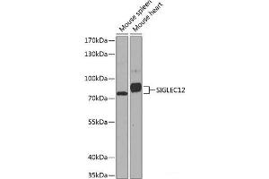 Western blot analysis of extracts of various cell lines using SIGLEC12 Polyclonal Antibody at dilution of 1:1000. (SIGLEC12 Antikörper)