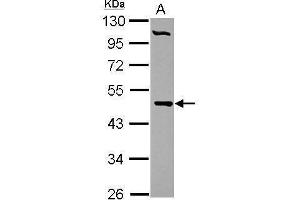 WB Image Sample (30 ug of whole cell lysate) A: HepG2 10% SDS PAGE antibody diluted at 1:1000 (PCYT2 Antikörper)
