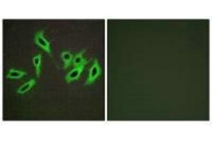 Immunofluorescence analysis of HepG2 cells, using Heparin Cofactor II antibody.