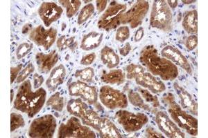 Image no. 2 for anti-TBC1 Domain Family, Member 13 (TBC1D13) antibody (ABIN1501310) (TBC1D13 Antikörper)