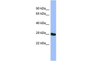 WB Suggested Anti-METTL5 Antibody Titration: 0. (METTL5 Antikörper  (N-Term))