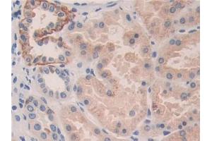 DAB staining on IHC-P; Samples: Human Kidney Tissue (KIR2DL3 Antikörper  (AA 22-342))