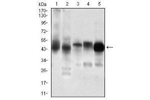 Western blot analysis using PDK2 mouse mAb against Jurkat (1), C6 (2), Cos7 (3), K562 (4), A431 (5) cell lysate. (PDK2 Antikörper  (AA 178-404))