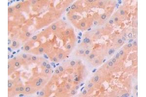 Detection of JAK2 in Human Kidney Tissue using Polyclonal Antibody to Janus Kinase 2 (JAK2) (JAK2 Antikörper  (AA 508-800))