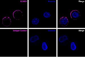 KCNQ1 was detected in live  colon adenocarcinoma cells by confocal microscopy using Anti-KCNQ1 (extracellular)-ATTO  Antibody (ABIN7885282, 1:25, magenta).