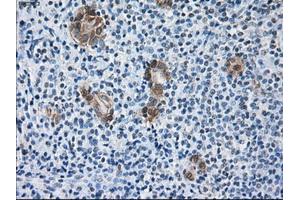 Immunohistochemical staining of paraffin-embedded Kidney tissue using anti-SORDmouse monoclonal antibody. (SORD Antikörper)