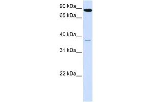 Synaptophysin antibody used at 1 ug/ml to detect target protein. (Synaptophysin Antikörper  (N-Term))