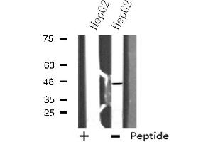 Western blot analysis of extracts from HepG2 cells using E2F2 antibody. (E2F2 Antikörper  (Internal Region))