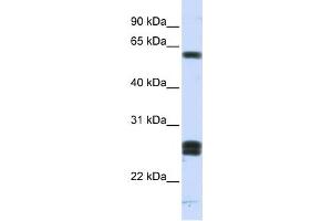 Western Blotting (WB) image for anti-Hyaluronan Binding Protein 2 (HABP2) antibody (ABIN2459800) (HABP2 Antikörper)