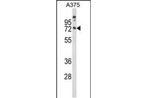 Western blot analysis of MAG Antibody in A375 cell line lysates (35ug/lane) (MAG Antikörper  (AA 439-466))