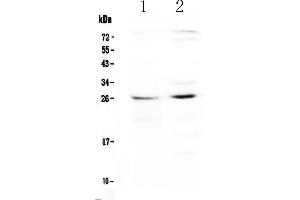 Western blot analysis of SLC31A1/CTR1 using anti-SLC31A1/CTR1 antibody . (SLC31A1 Antikörper)