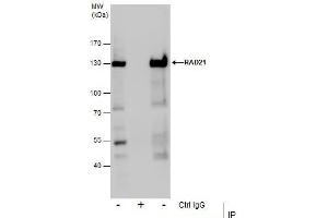 IP Image Immunoprecipitation of RAD21 protein from Jurkat whole cell extracts using 5 μg of RAD21 antibody, Western blot analysis was performed using RAD21 antibody, EasyBlot anti-Rabbit IgG  was used as a secondary reagent. (RAD21 Antikörper  (Center))