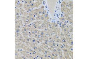 Immunohistochemistry of paraffin-embedded human liver using EIF2S3 antibody at dilution of 1:100 (x40 lens).