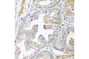 Immunohistochemistry of paraffin-embedded human prostate using CFD antibody at dilution of 1:100 (40x lens). (Adipsin Antikörper)