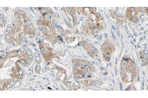 ABIN6279041 at 1/100 staining Human prostate tissue by IHC-P. (RPL18A Antikörper  (Internal Region))