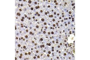 Immunohistochemistry of paraffin-embedded mouse liver using HIRIP3 antibody (ABIN5974221) at dilution of 1/100 (40x lens). (HIRIP3 Antikörper)