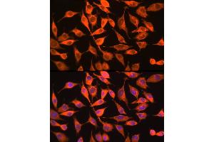 Immunofluorescence analysis of L929 cells using PITPNA Rabbit pAb (ABIN6132492, ABIN6145687, ABIN6145688 and ABIN6216795) at dilution of 1:100 (40x lens). (PITPNA Antikörper  (AA 211-270))