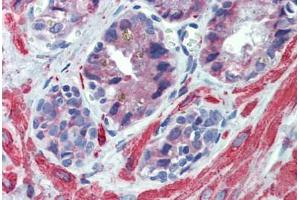 Immunohistochemistry (Formalin-fixed Paraffin-embedded Sections) (IHC (fp)) image for anti-Insulin-Like Growth Factor Binding Protein 4 (IGFBP4) (AA 180-229) antibody (ABIN6744434)