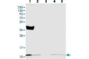 Western blot analysis of Lane 1: RT-4, Lane 2: U-251 MG, Lane 3: Human Plasma, Lane 4: Liver, Lane 5: Tonsil with TIMM10 polyclonal antibody  at 1:250-1:500 dilution. (TIMM10 Antikörper)