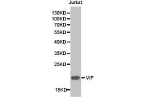 Western blot analysis of extracts of Jurkat cell lines, using VIP antibody.