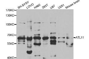Western Blotting (WB) image for anti-Atlastin GTPase 1 (ATL1) antibody (ABIN1876490) (ATL1 Antikörper)