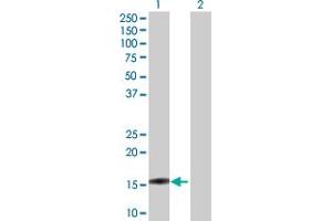 Western Blot analysis of BIRC5 expression in transfected 293T cell line by BIRC5 MaxPab polyclonal antibody. (Survivin Antikörper  (AA 1-142))