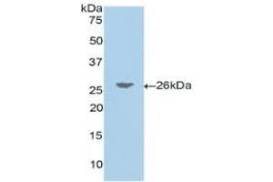 Western blot analysis of recombinant Human JAG1. (JAG1 Antikörper  (AA 33-250))