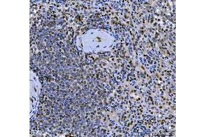 IHC analysis of SCML1 using anti-SCML1 antibody (ABIN7602479).