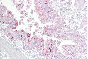 Immunohistochemistry with Lung, respiratory epithelium tissue at an antibody concentration of 5µg/ml using anti-PA2G4 antibody (ARP47601_P050) (PA2G4 Antikörper  (C-Term))