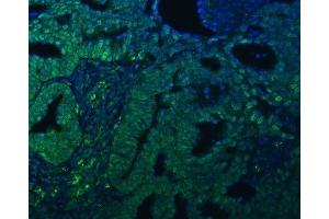 IF analysis of TRMT61A using anti-TRMT61A antibody (ABIN7599220).