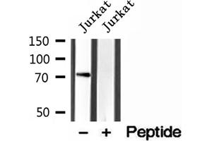 Western blot analysis of extracts of Jurkat cells, using VISA antibody.
