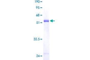 PCTP Protein (AA 1-214) (GST tag)