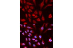 Immunofluorescence analysis of U20S cell using UHRF1 antibody. (UHRF1 Antikörper)