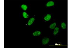 Immunofluorescence of purified MaxPab antibody to C20orf20 on HeLa cell.