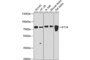 Western blot analysis of extracts of various cell lines, using IFT74 antibody (ABIN6127640, ABIN6142220, ABIN6142222 and ABIN6216400) at 1:3000 dilution. (IFT74 Antikörper  (AA 1-372))
