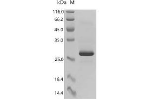 (Tris-Glycine gel) Discontinuous SDS-PAGE (reduced) with 5 % enrichment gel and 15 % separation gel.
