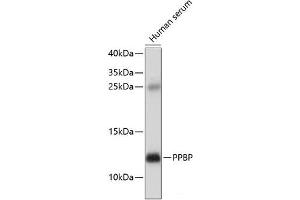 Western blot analysis of extracts of Human serum using PPBP Polyclonal Antibody at dilution of 1:1000. (CXCL7 Antikörper)