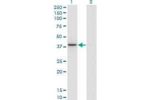 Western Blot analysis of PARVG expression in transfected 293T cell line by PARVG monoclonal antibody (M01A), clone 4E1. (PARVG Antikörper  (AA 1-331))
