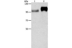 Western Blot analysis of Huvec cell and Human placenta tissue using CD61 Polyclonal Antibody at dilution of 1:500 (Integrin beta 3 Antikörper)
