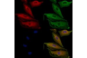 ABIN6264389 and ABIN6279692 staining  cells by IF/ICC. (PPP1R3D Antikörper  (Internal Region))