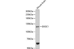 Western blot analysis of extracts of mouse brain, using EXOC1 Antibody (ABIN6129575, ABIN6140361, ABIN6140362 and ABIN6224778) at 1:3000 dilution. (EXOC1 Antikörper  (AA 645-894))