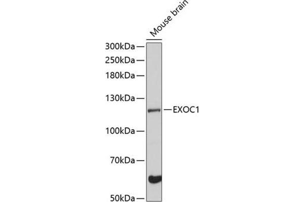 EXOC1 antibody  (AA 645-894)
