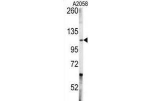 Western Blotting (WB) image for anti-C-Abl Oncogene 1, Non-Receptor tyrosine Kinase (ABL1) antibody (ABIN3003438) (ABL1 Antikörper)